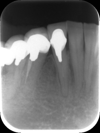 0000000726__IntraOral_20130220162819.jpg