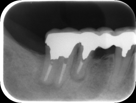 0000000726__IntraOral_20130225171253.jpg