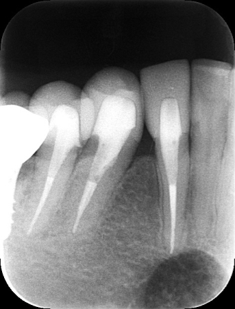 0000000726__IntraOral_20170619164846.jpg